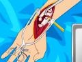 เกม Arm surgery 2