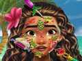 เกม Moana Skin Doctor