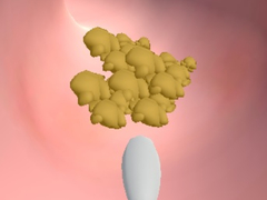 เกม Earwax Clinic